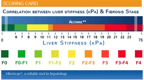 bad fibroscan results|FibroScan® and Liver Disease .